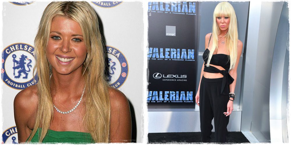 Tara Reid és a plasztika