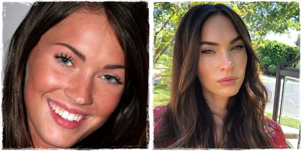 Emlékszel még, hogyan nézett ki Megan Fox a plasztikai műtétek előtt?