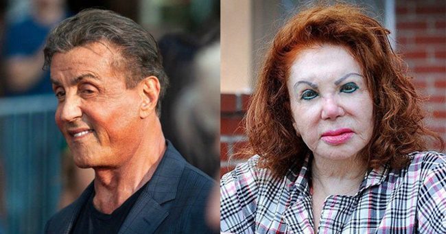 Miből mi lett - Sylvester Stallone és Jackie Stallone is a plasztikai műtétek áldozatai lettek