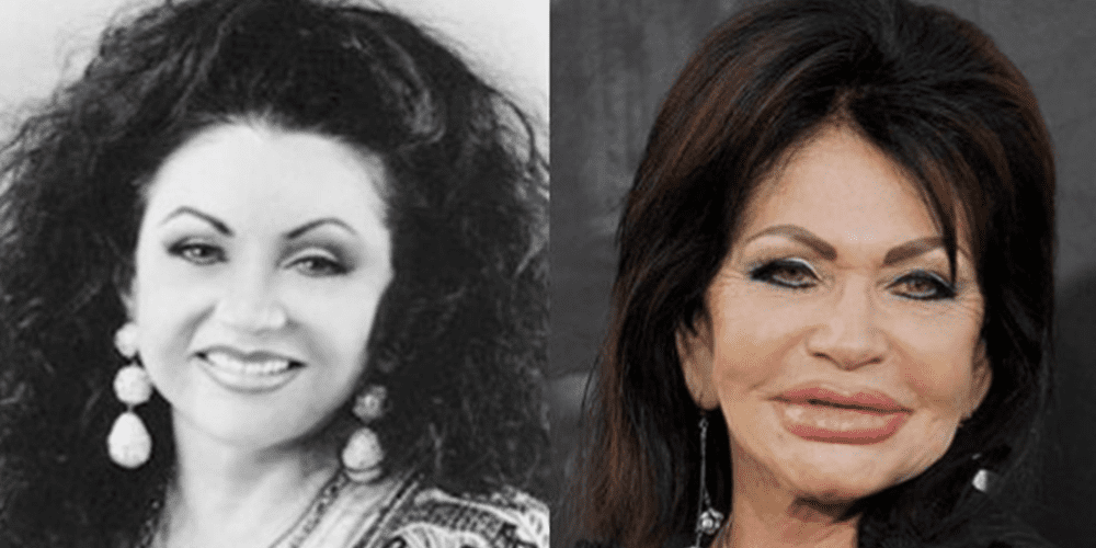 Miből mi lett - Sylvester Stallone és Jackie Stallone is a plasztikai műtétek áldozatai lettek