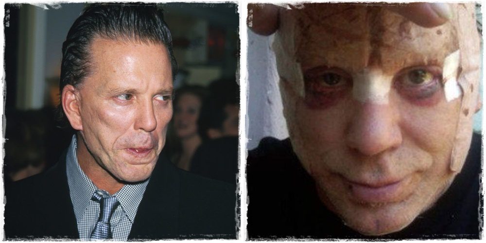 Mickey Rourke a 80-as évek legsármosabb pasija volt, mára felismerhetetlenné vált