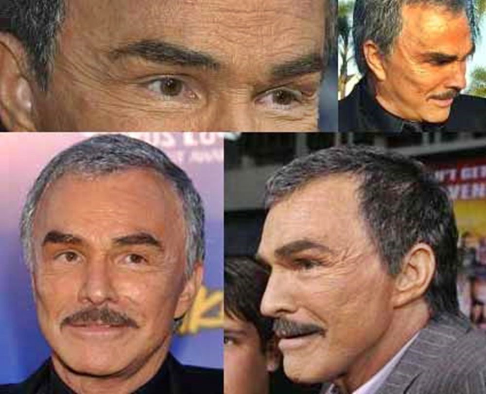 Szegény Burt Reynolds, a halála előtt már fel sem lehetett ismerni a sok plasztikai beavatkozástól