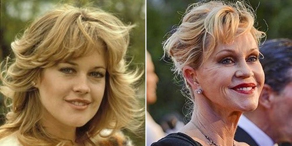 Melanie Griffith újabb áldozata annak, amikor a plasztikai beavatkozások rosszul sülnek el