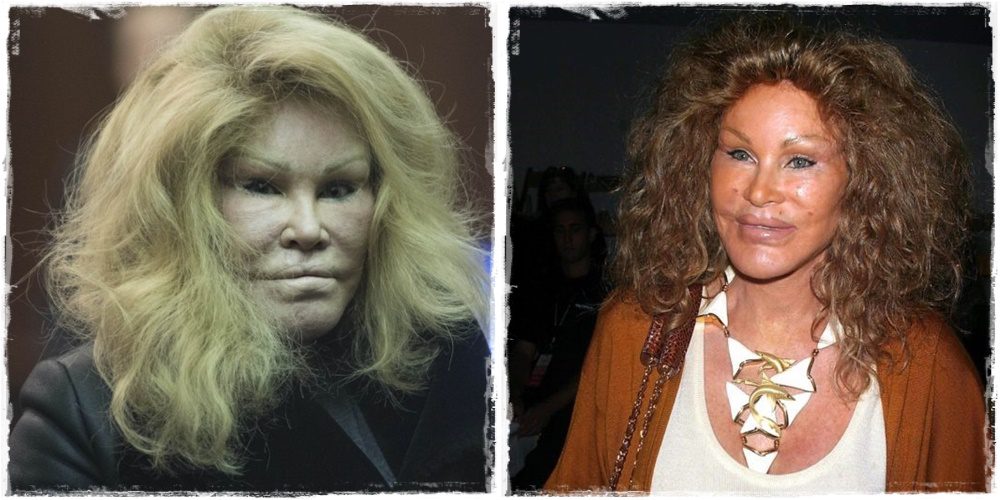 Jocelyn Wildenstein