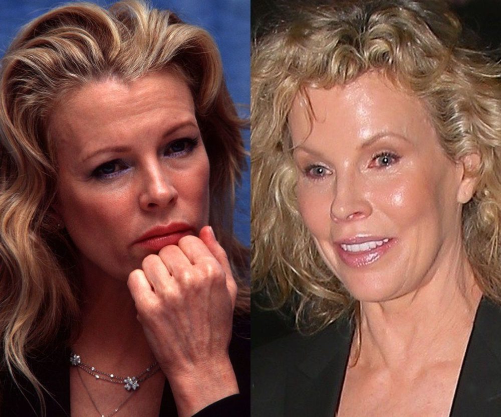 Az Oscar-díjas színésznő, Kim Basinger