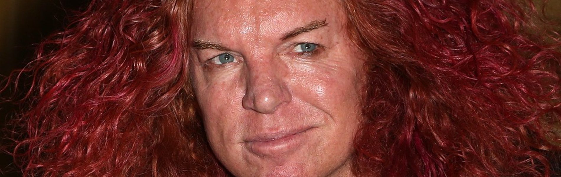 A Répafejként ismertté vált Carrot Top a plasztikázott celebek réme