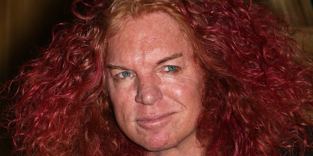 A Répafejként ismertté vált Carrot Top a plasztikázott celebek réme