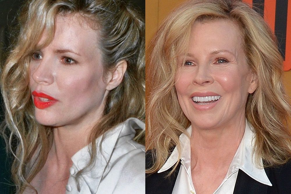 Az Oscar-díjas színésznő, Kim Basinger