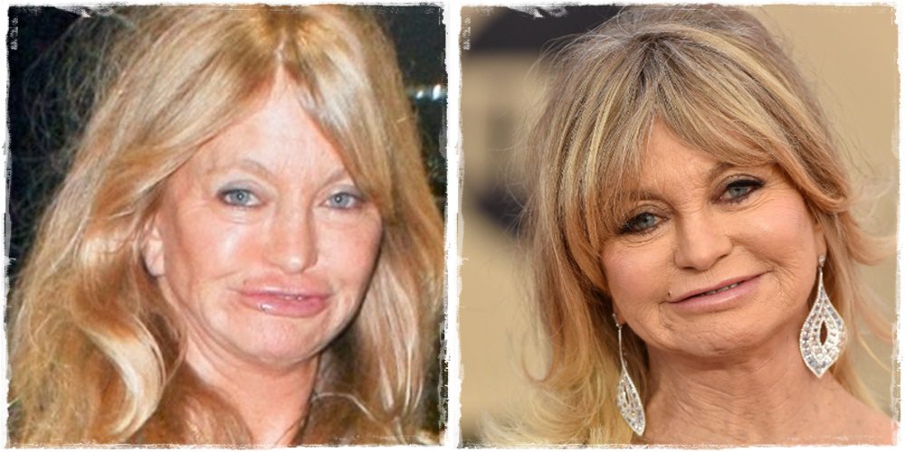 Emlékszel még a bájos Goldie Hawn-ra? Ma már nyomokban sem hasonlít régi önmagára