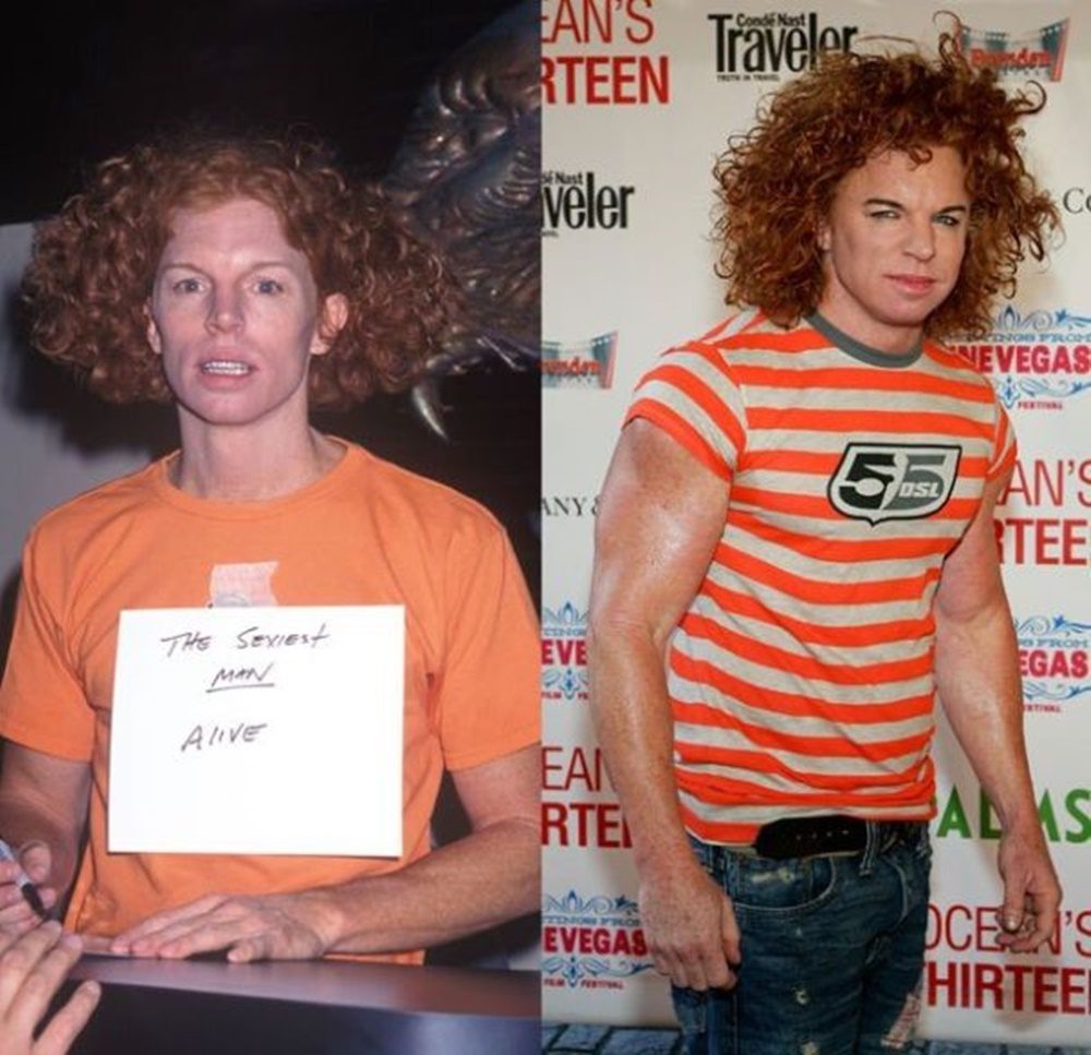 A Répafejként ismertté vált Carrot Top a plasztikázott celebek réme