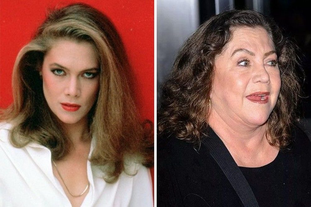 Emlékszel rá? A 90-es évek szőke bombázója, Kathleen Turner durván leépült