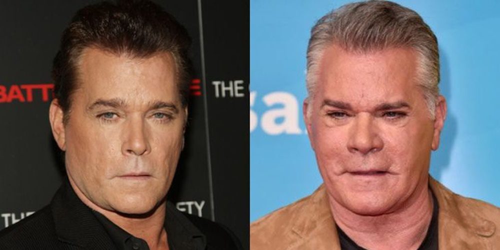 Döbbenet! Az egykori szívtipró, Ray Liotta durván szétszabatta arcát