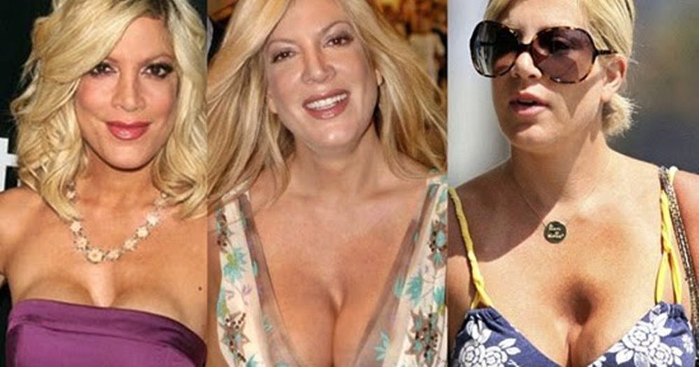 Tori Spelling többek között a nagysikerű Beverly Hills 90210 című sorozatban szerepelt, de emellett több filmben is láthatták a nézők.