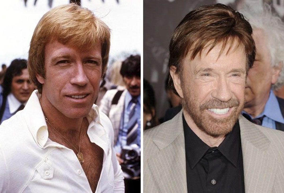 Bármilyen hihetetlen, de a plasztikai beavatkozásoknak sikerült elbánni Chuck Norrissal