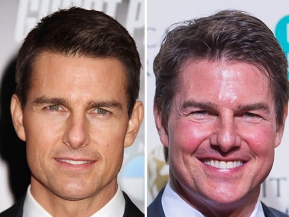 Megdöbbensz Tom Cruise plasztika előtti és utáni képén!