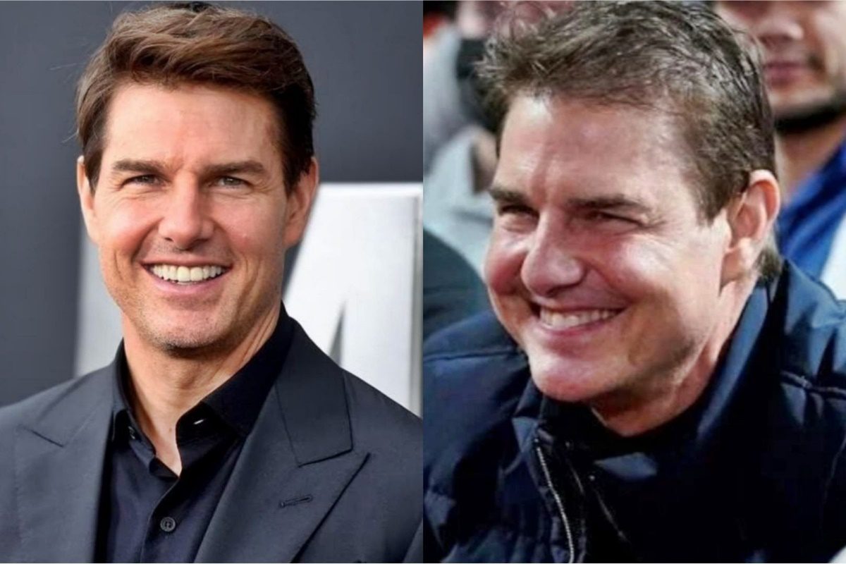 Emlékszel még, hogyan nézett ki Tom Cruise a plasztikai műtétek előtt?