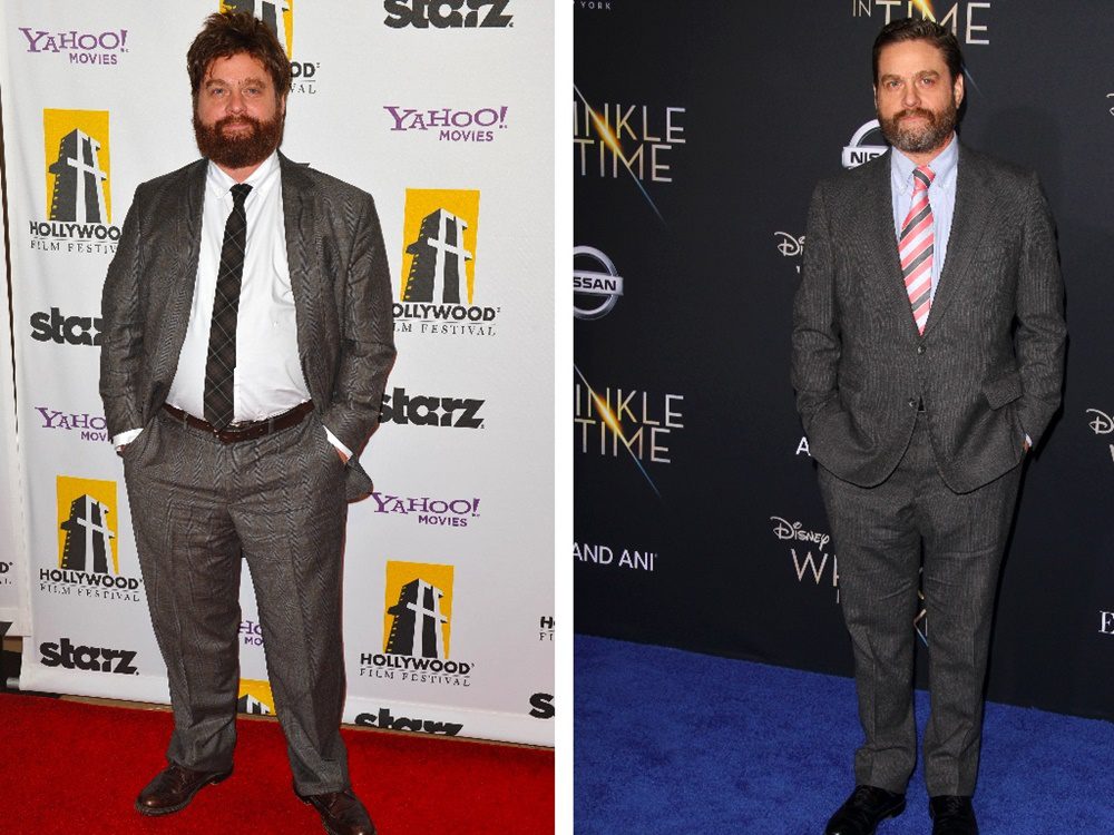 Zach Galifianakis