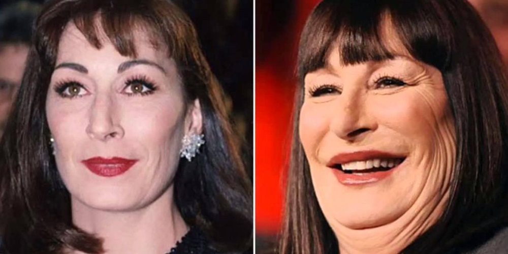 A 70 éves Anjelica Huston mára teljesen felismerhetetlenné vált