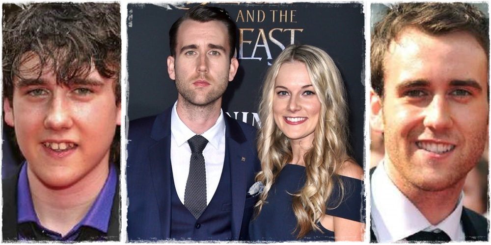 Azta! Így nézett ki a Harry Potterből ismert színész Matthew Lewis fogsora, mielőtt megcsináltatta volna