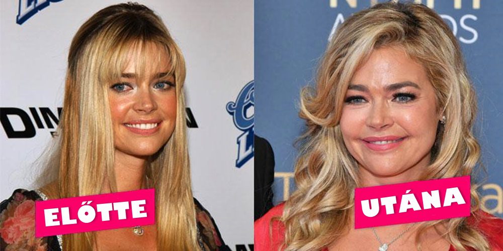 Mit művelt magával? Így néz ki Denise Richards a plasztikai beavatkozások után