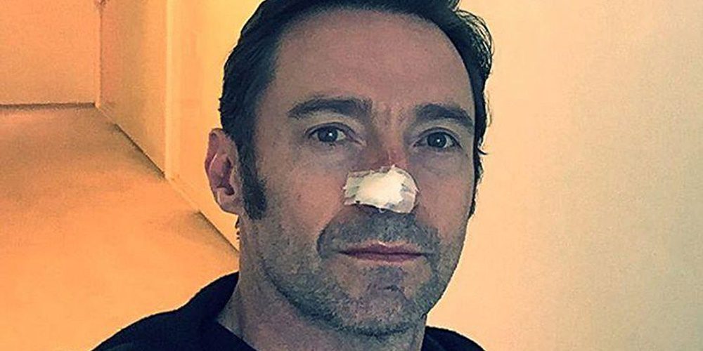 Szomorú bejelentést tett Hugh Jackman: súlyos betegséggel kell együtt élnie a színésznek