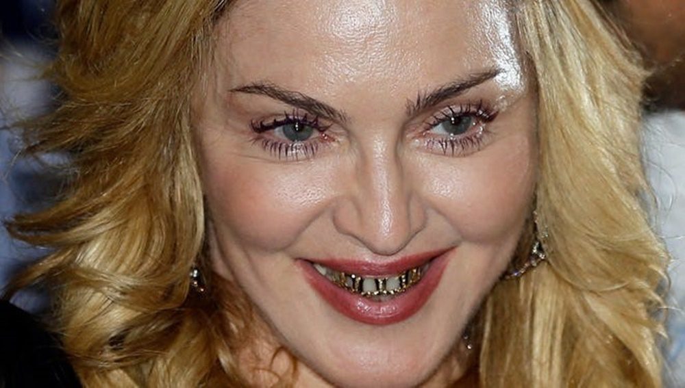 Nem is hitted volna, milyenek voltak Madonna fogai, mielőtt megcsináltatta volna