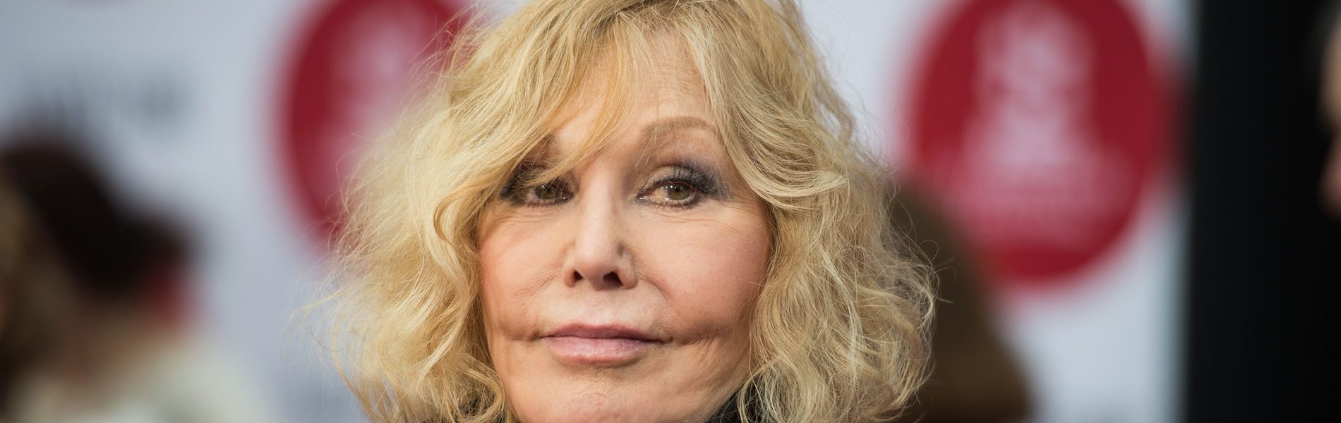 Végképp eltorzult az arca! Rémmé műtette magát az egykori szexszimbólum