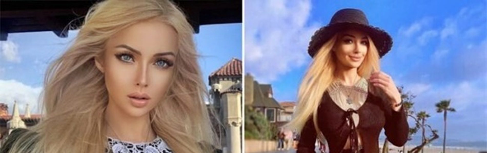 Végképp eltorzult a teste! Borzasztóvá műtette magát az emberi Barbie