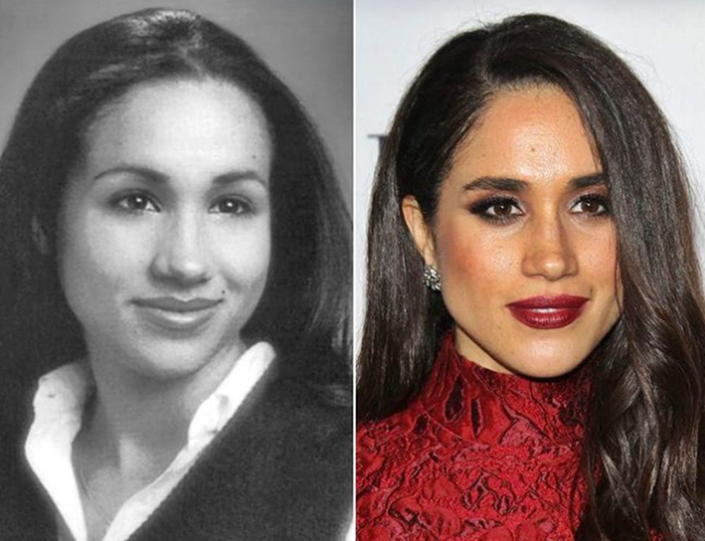 Alig lehet ráismerni: így nézett ki 18 évesen Meghan Markle, a sok plasztika előtt