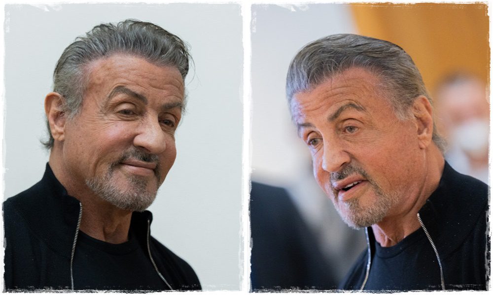 Ma már alig hasonlít a régi énjére - Sylvester Stallone arca durván szét van műtve