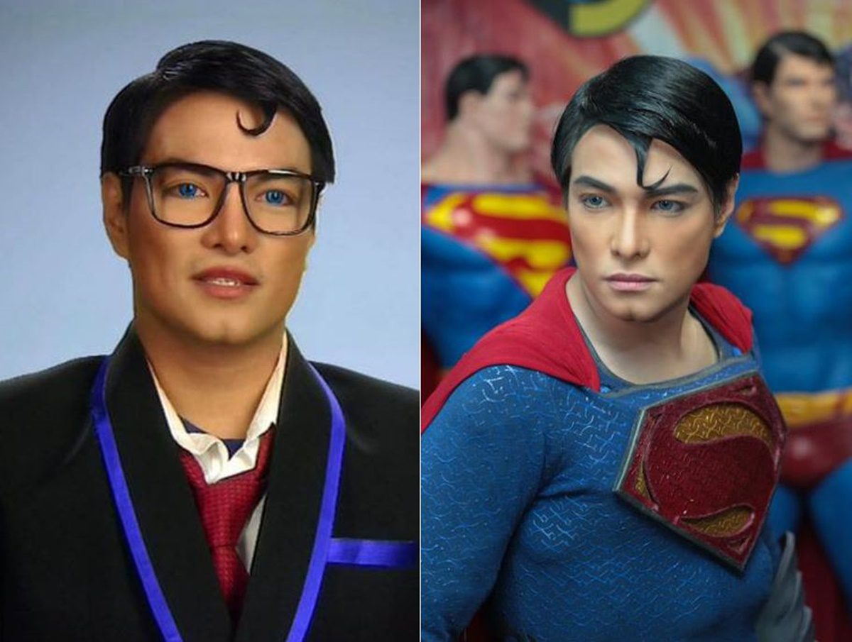 Döbbenet! Superman szeretett volna lenni, felismerhetetlenné vált a sok plasztikától
