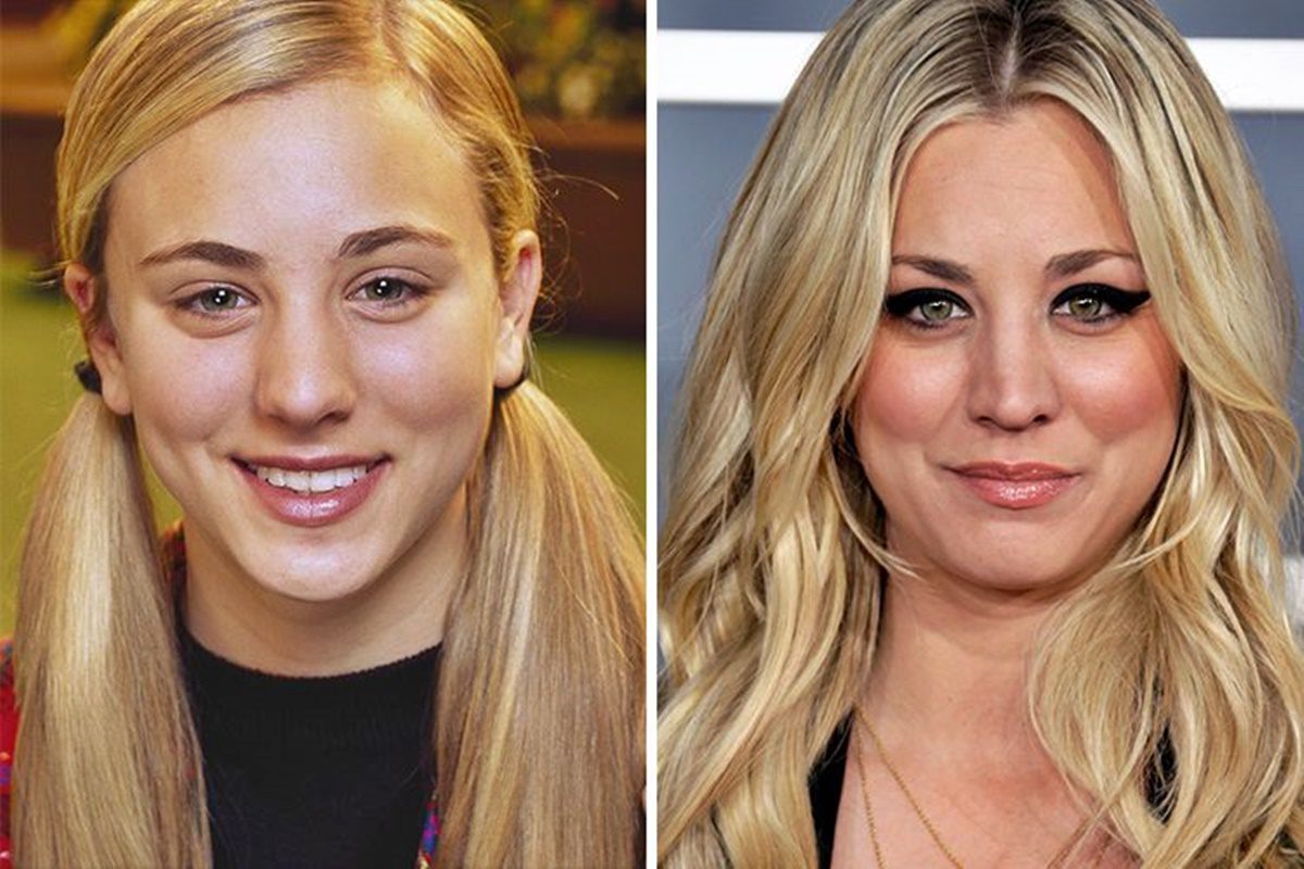 Kaley Cuoco arcát teljesen tönkretette a plasztika