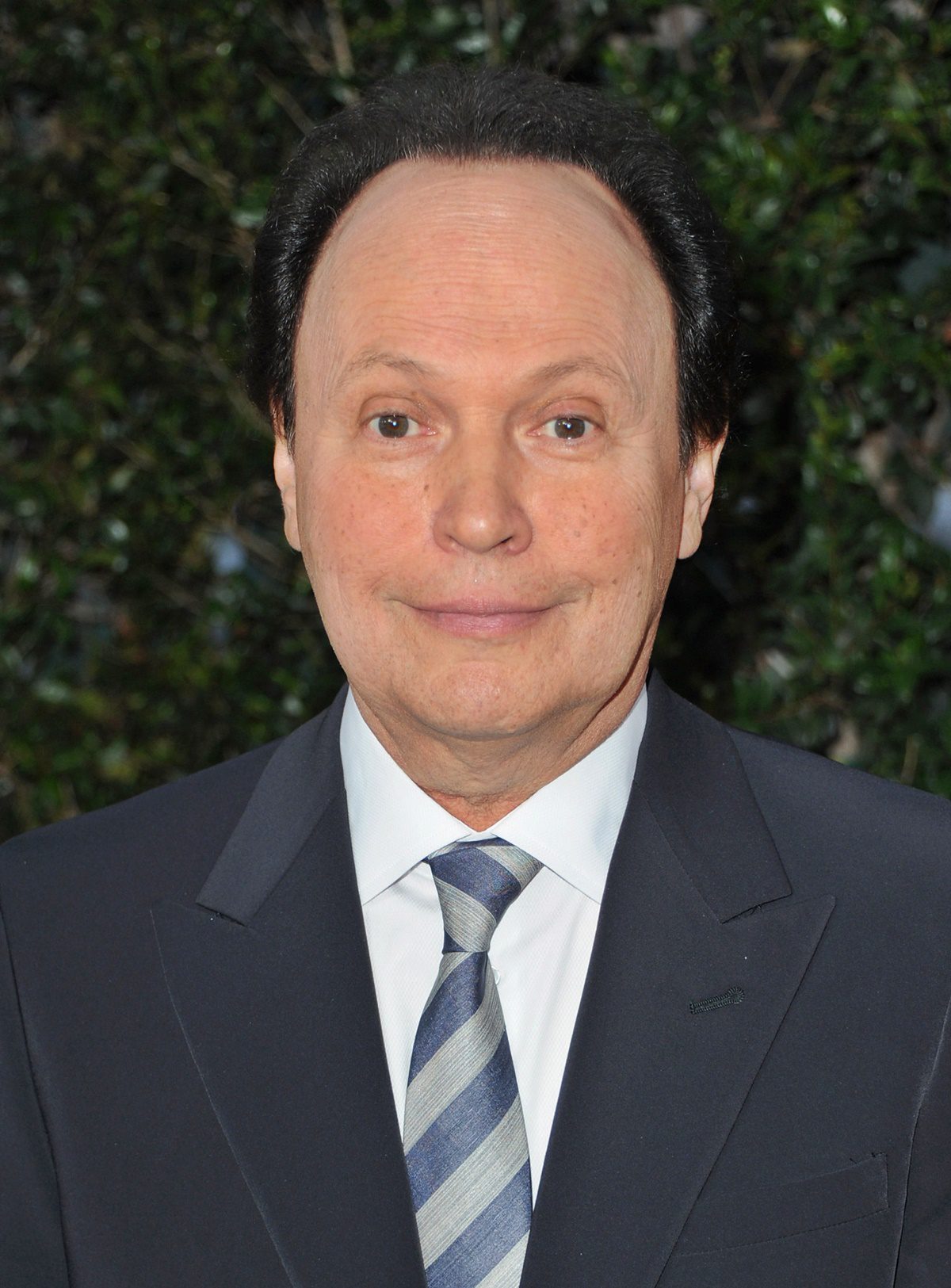 Billy Crystal arcát teljesen tönkretette a plasztika