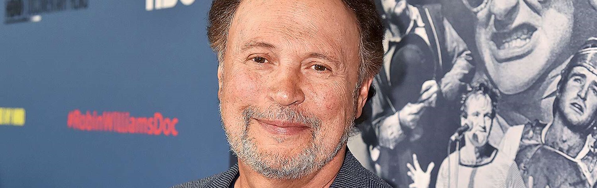 Billy Crystal arcát teljesen tönkretette a plasztika