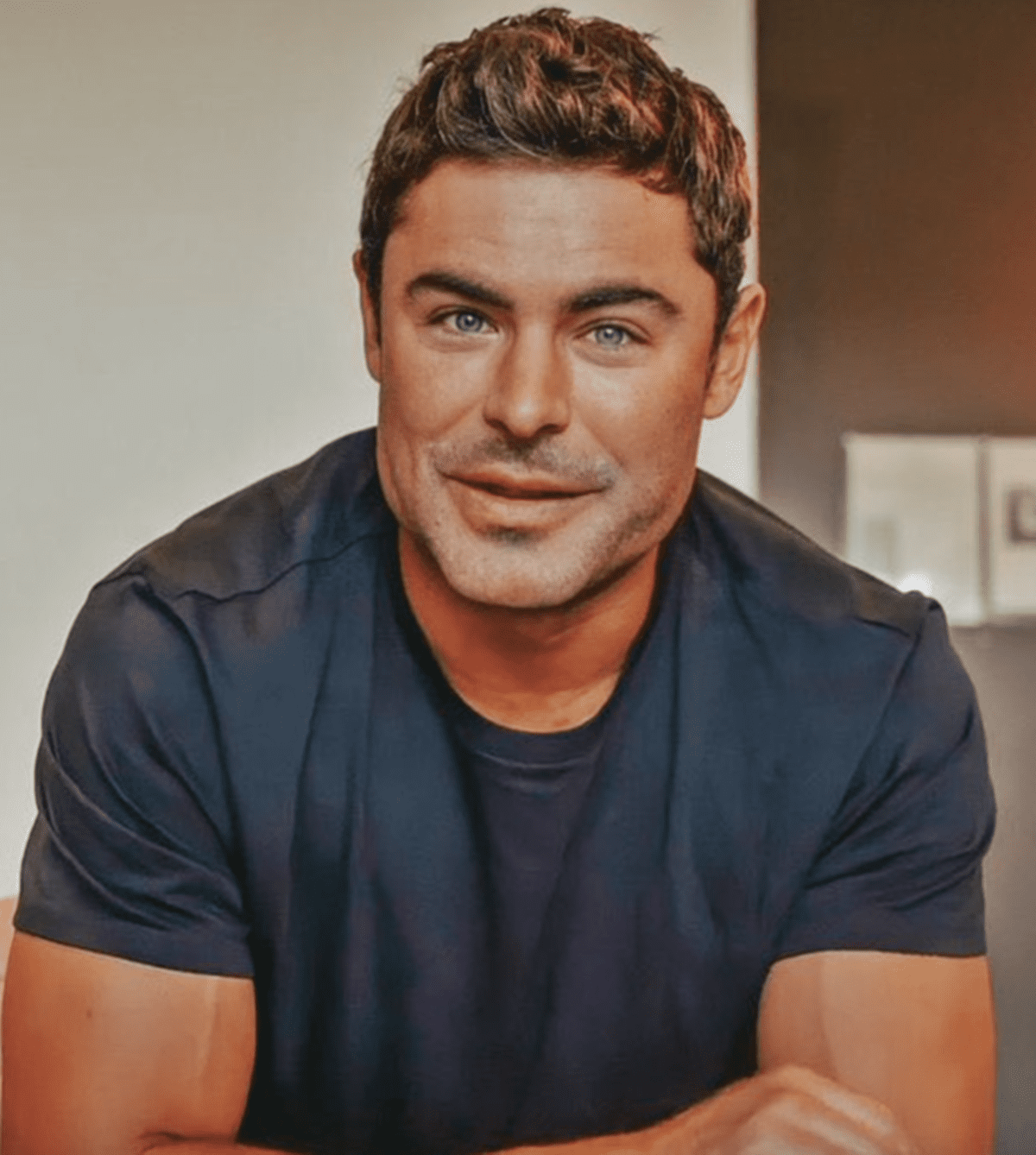 Zac Efron arcát teljesen tönkretette a botox