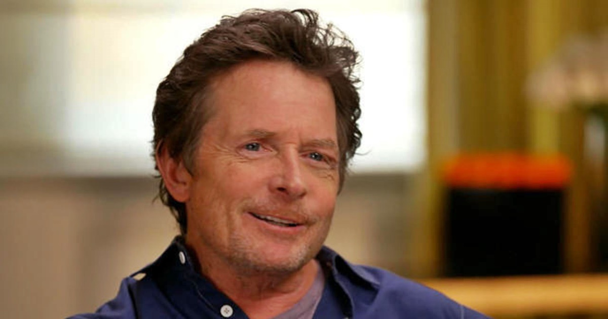 Michael J. Fox arról vallott szomorúan, hogy már elvesztette a rövidtávú memóriáját