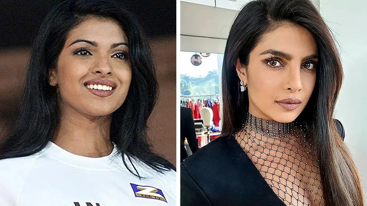 A világ egyik legszebb színésznője ki sem mert mozdulni otthonról az elrontott szépészeti műtét után - Priyanka Chopra