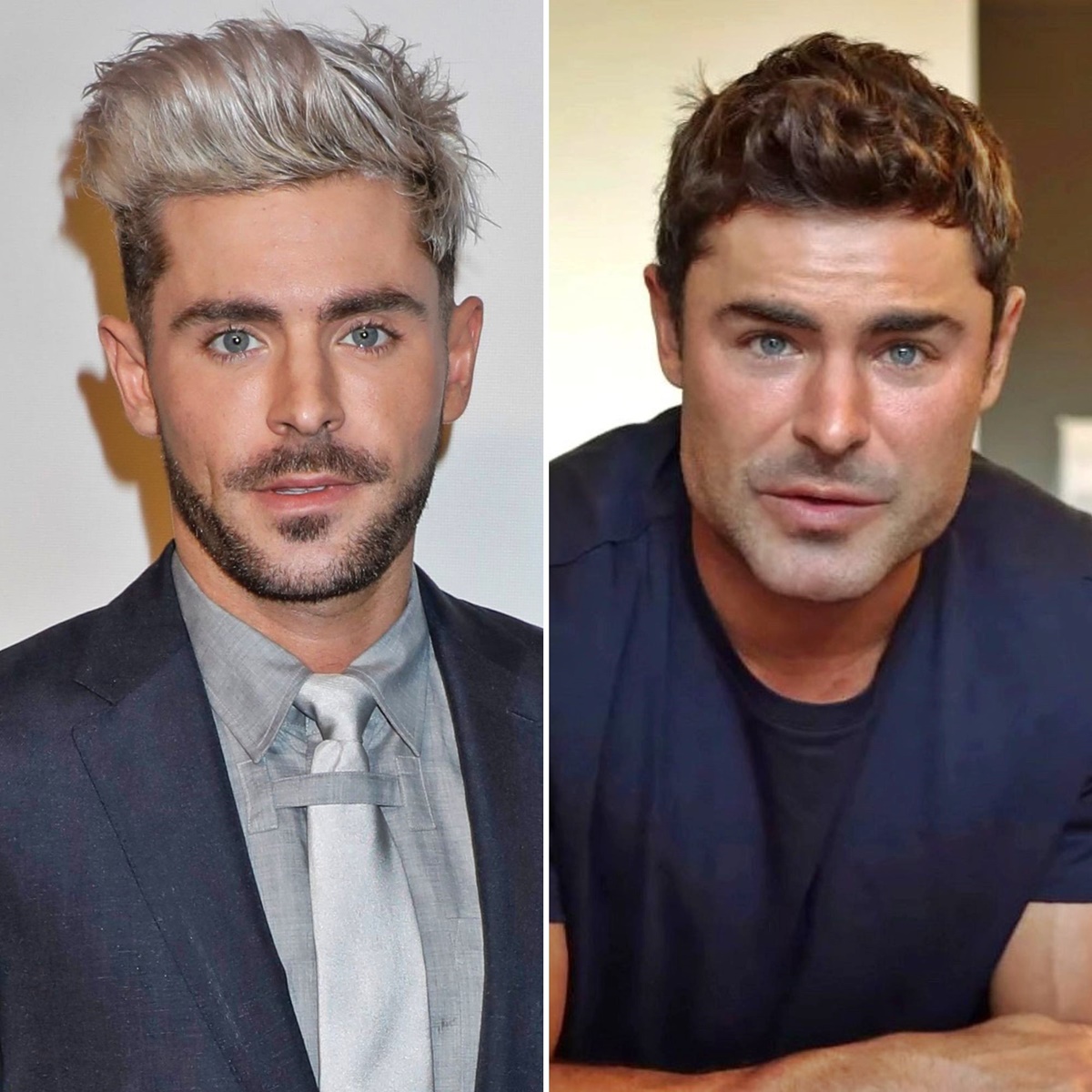 Sokkoló fotók Zac Efron-ról – Az egykori szívtipró arcát fel sem lehet ismerni