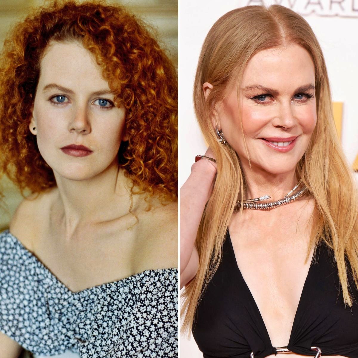 Ijesztő, mit tett magával: Nicole Kidman arca teljesen felismerhetetlen lett
