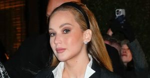 A durva plasztikával vádolt Jennifer Lawrence bevallotta, miért változott meg ilyen látványosan az arca