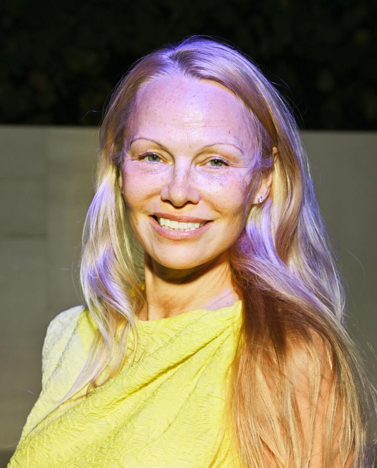 Sokkoló fotók Pamela Anderson-ról – Az egykori dögös színésznő arcát fel sem lehet ismerni