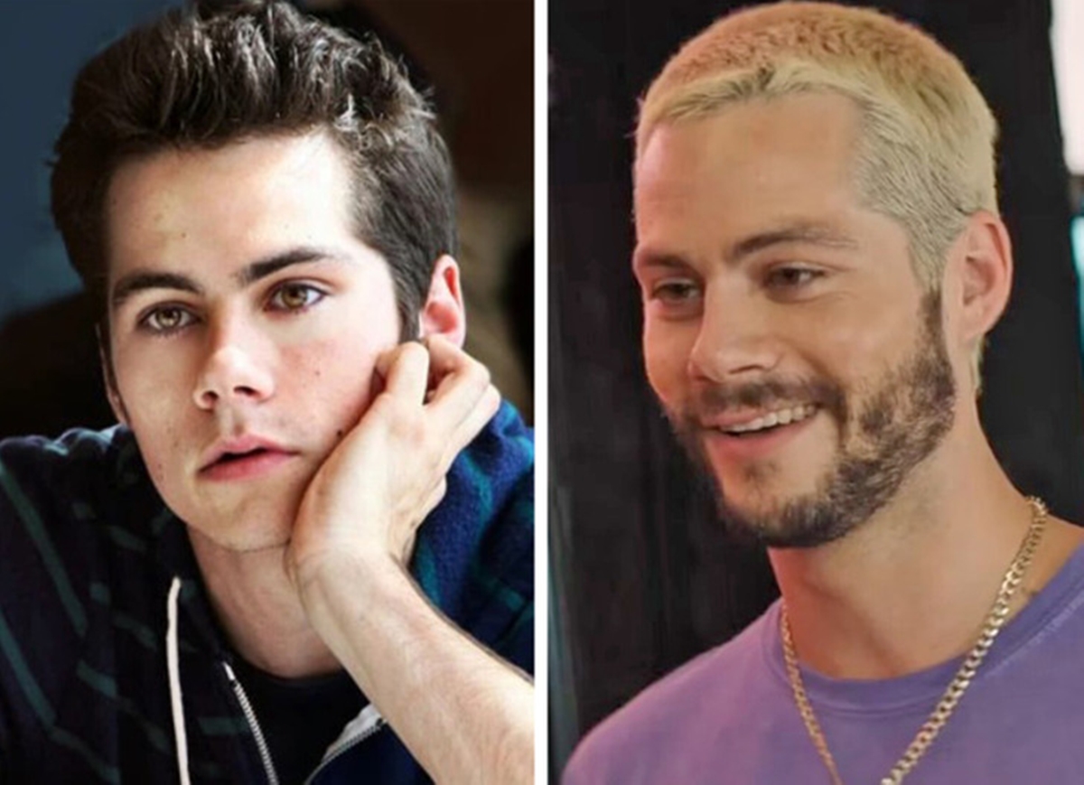 Ennyit változtak a Teen Wolf – Farkasbőrben című sorozat sztárjai az évek során