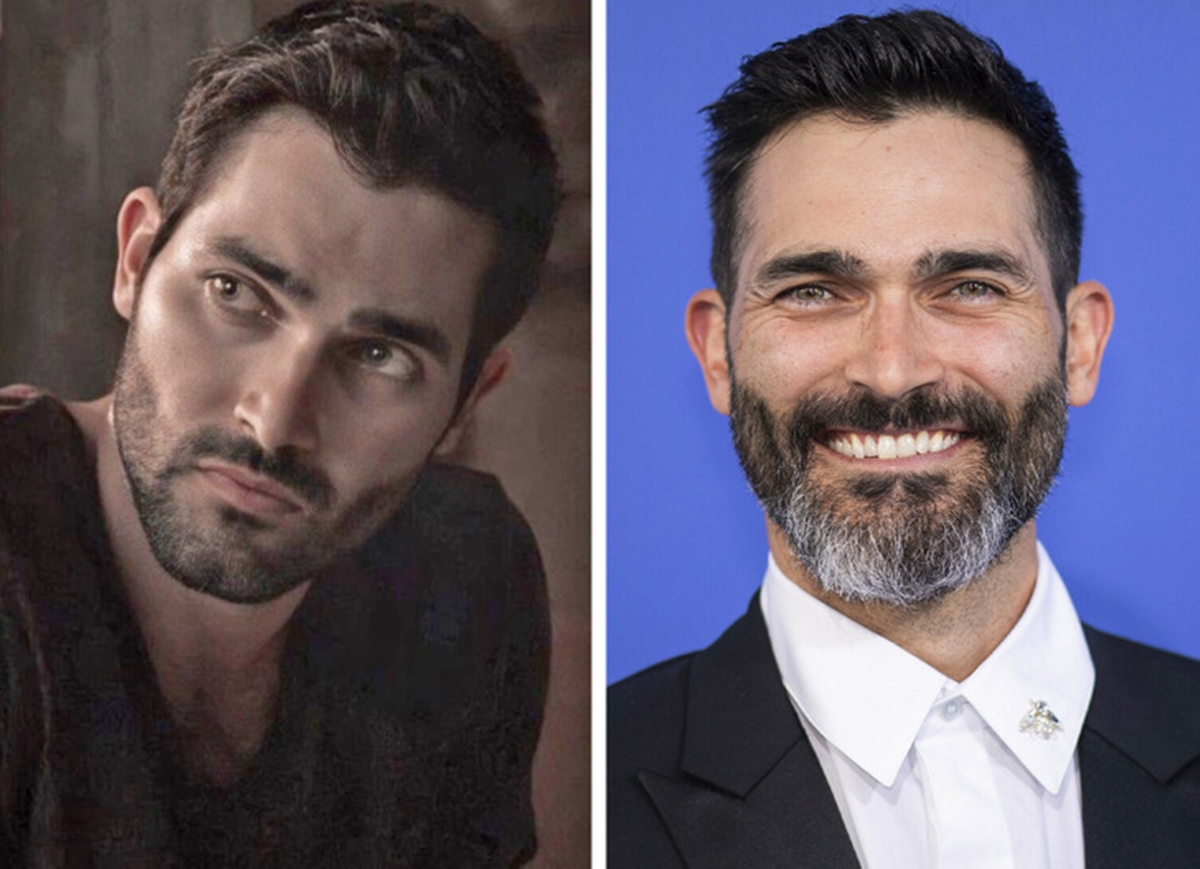 Ennyit változtak a Teen Wolf – Farkasbőrben című sorozat sztárjai az évek során