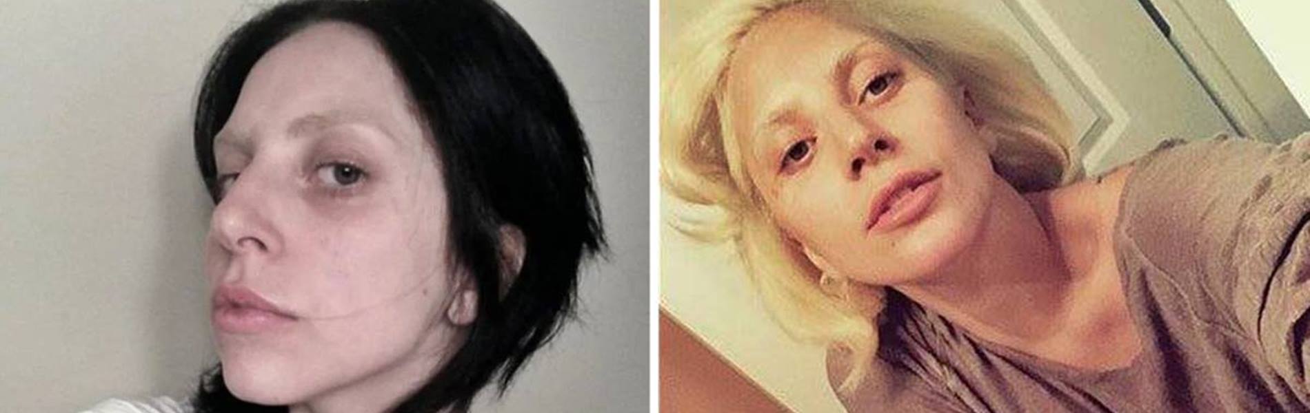 A képeken, smink nélkül látható nő egy igazi világsztár - Rájössz, hogy ki ő valójában? - Lady Gaga smink nélkül