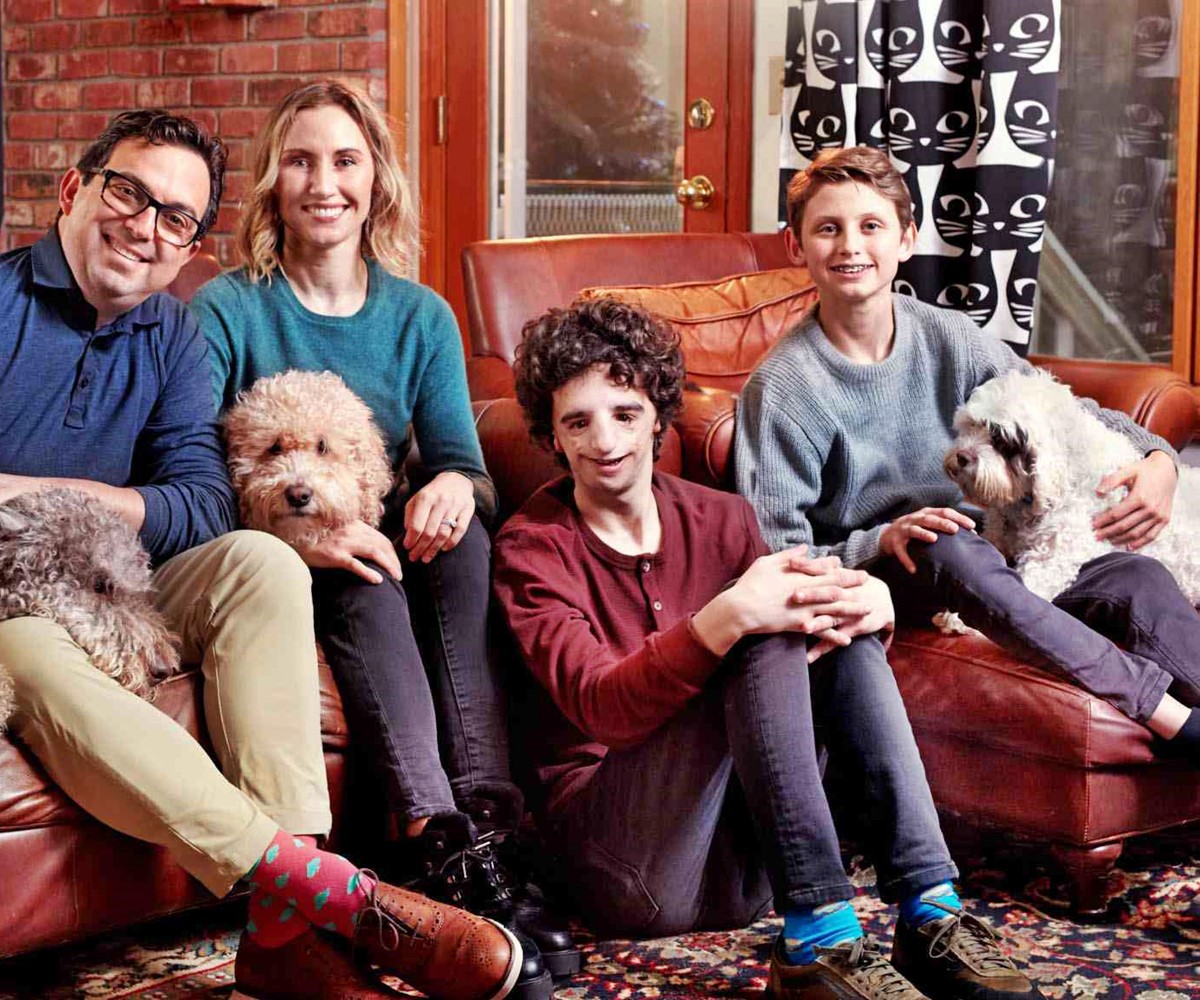 Emlékszel még Az igazi csodára? Így él ma az arcdeformitással született kisfiú, aki inspirálta a filmet - Nathaniel Newman