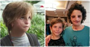 Emlékszel még Az igazi csodára? Így él ma az arcdeformitással született kisfiú, aki inspirálta a filmet - Nathaniel Newman