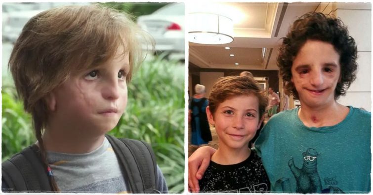 Emlékszel még Az igazi csodára? Így él ma az arcdeformitással született kisfiú, aki inspirálta a filmet - Nathaniel Newman