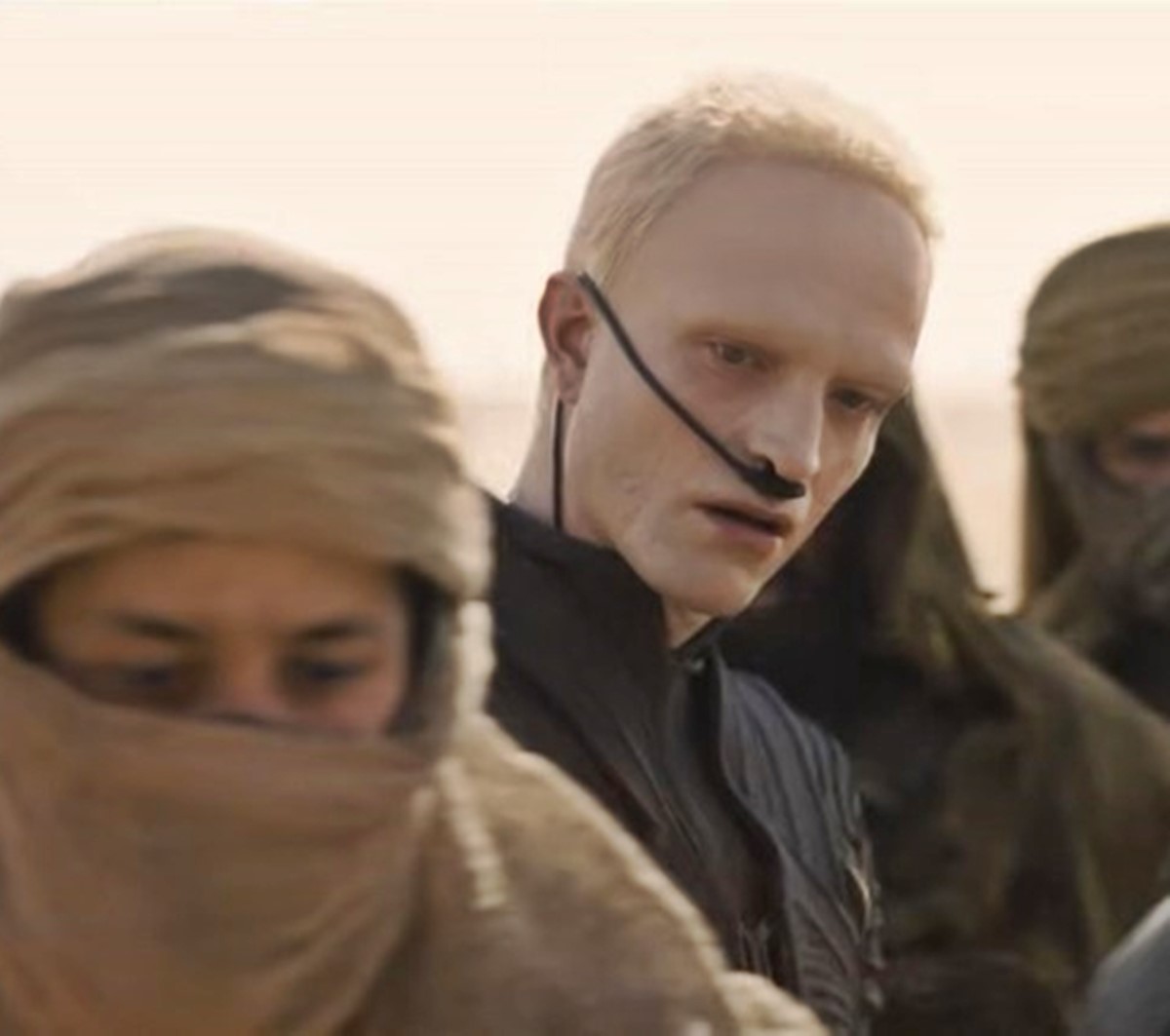 Mi történt a jóképű Robert Pattinson-nal - A színész drámaian megváltozott legfrissebb fotóján